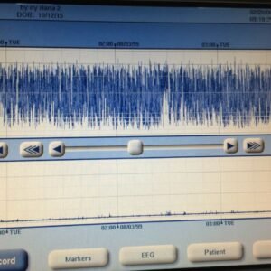 aeeg01