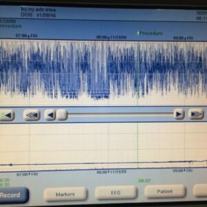 aeeg02
