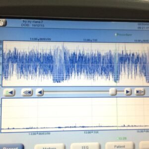 aeeg03