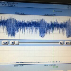 aeeg04