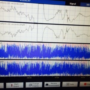 aeeg05