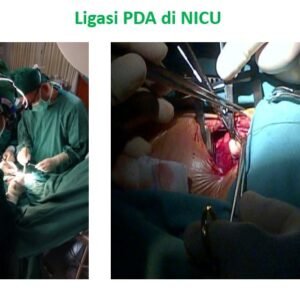 ligasipda